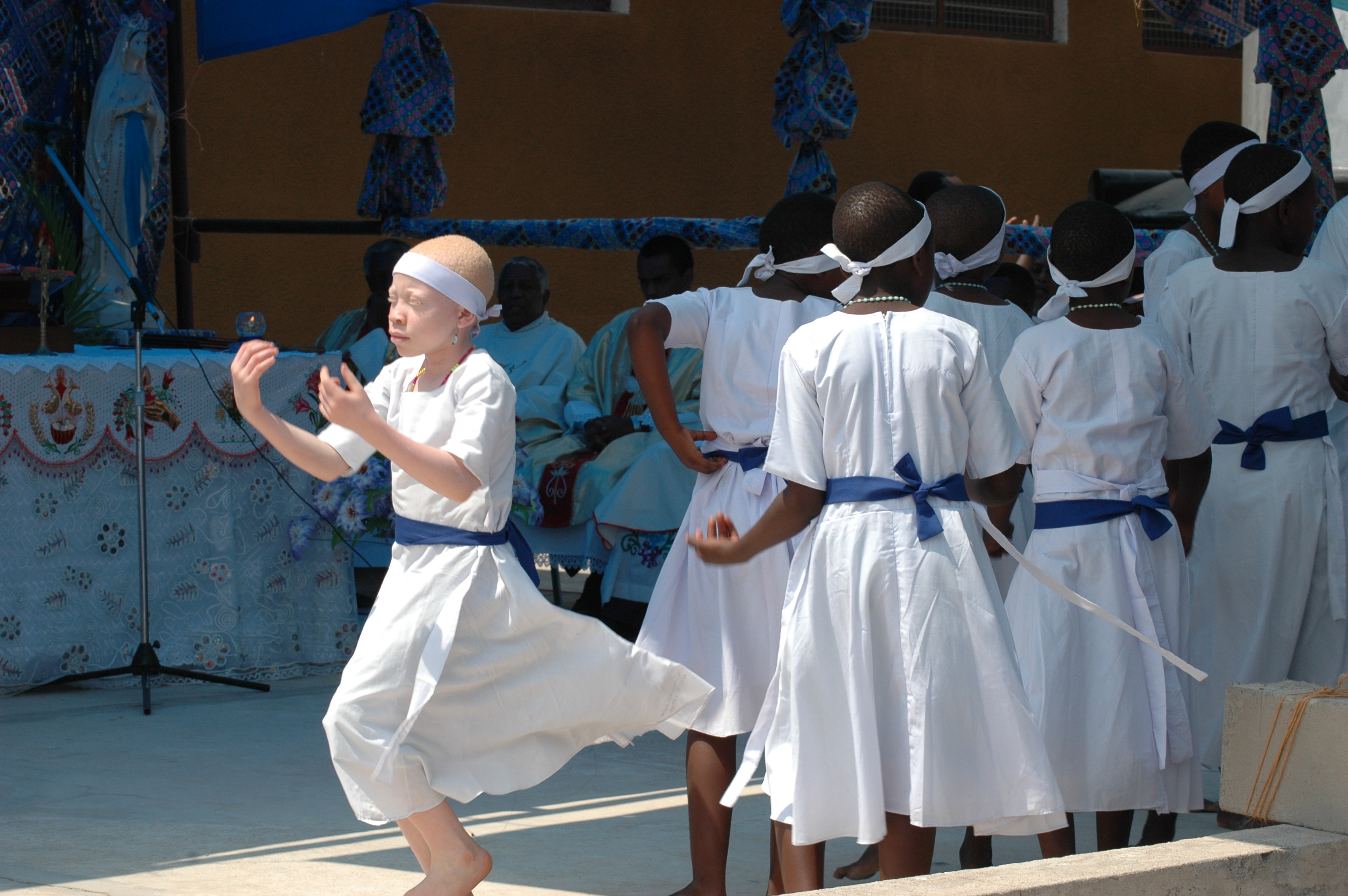 Dancing Albino Girls