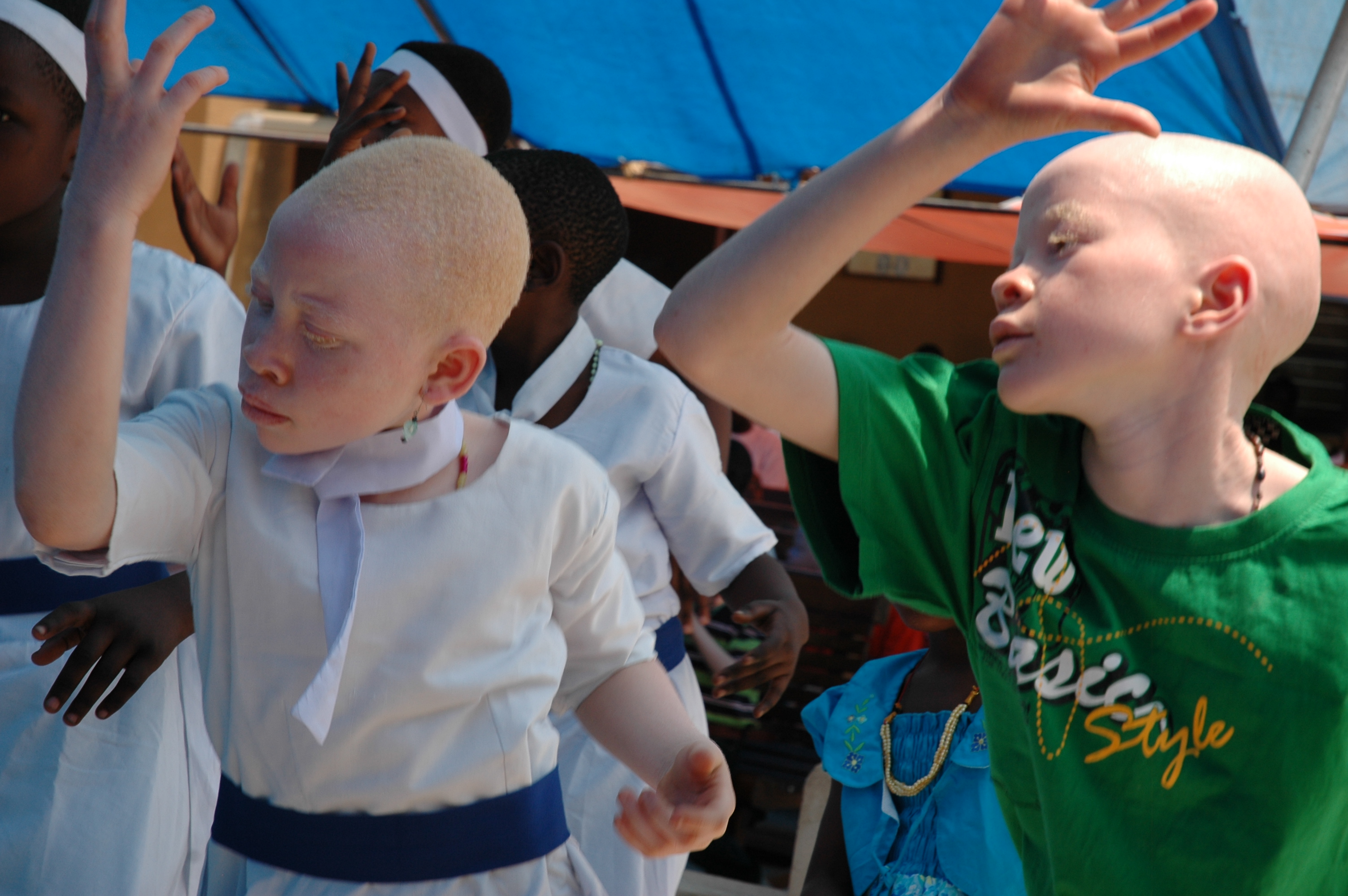 Dancing Albino Girls